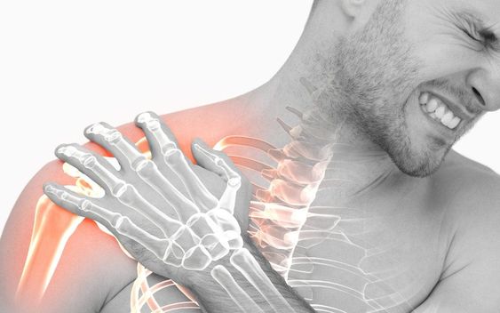 Gãy xương vai là nguyên nhân thường thấy dẫn đến những cơn đau bả vai