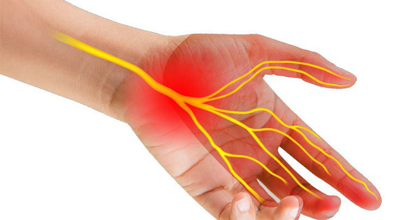 Đau nhức cổ tay, tê bì các ngón là triệu chứng của đau cổ tay