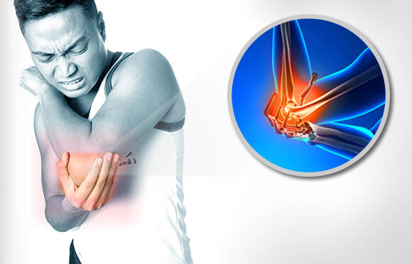 Tình trạng đau khuỷu tay là gì